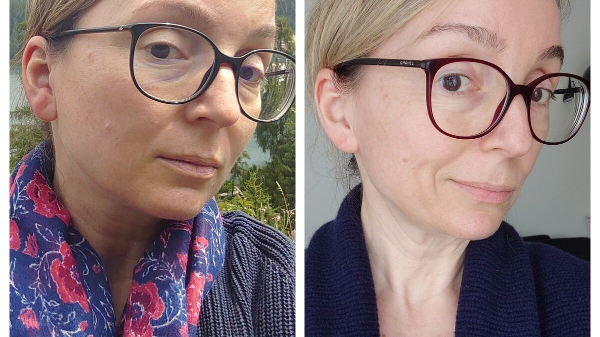 80 kg vs 63 kg: Jak uratowałam owal twarzy? Moja 4-letnia przygoda z Foreo Bear